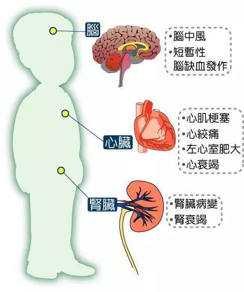 老人发生高血压脑出血的5大护理要素，你知道吗？