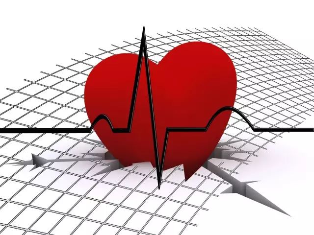 体检报告里面的“窦性心律”是个什么鬼？